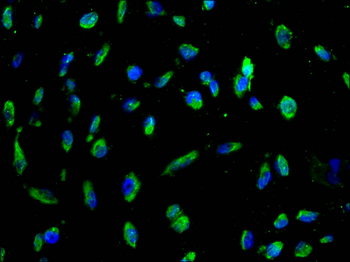 ADIPOR1 Antibody