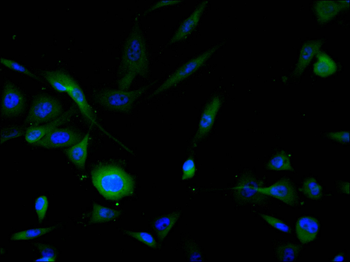 TH Antibody