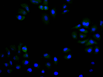 UNG Antibody