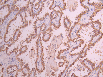 KRT18 Antibody