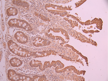 KRT18 Antibody
