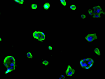 KRT18 Antibody