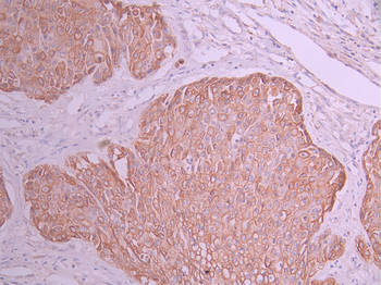 ATG5 Antibody