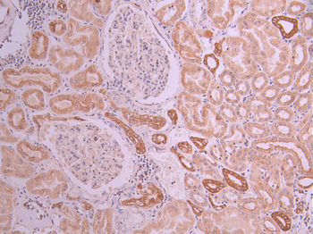 ATG5 Antibody