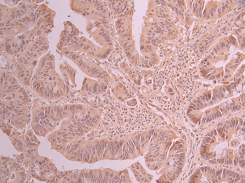 DDX20 Antibody