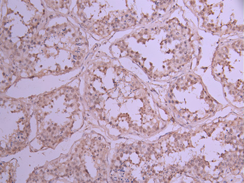 DDX20 Antibody