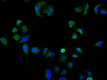 DDX20 Antibody
