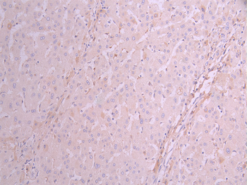 RAB7A Antibody