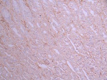 RAB7A Antibody
