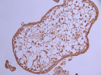 CCNE2 Antibody