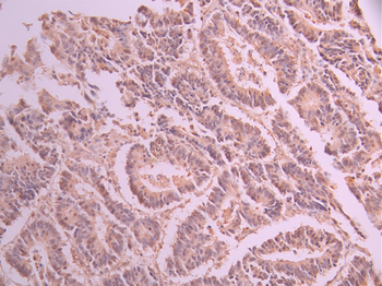 CCNB2 Antibody