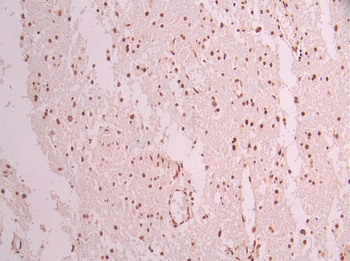 CDK9 Antibody