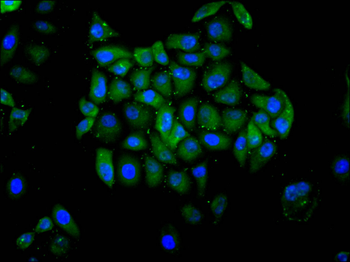 SMAD1 Antibody