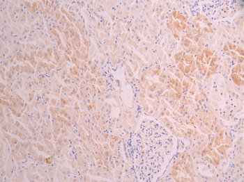 PIK3R4 Antibody