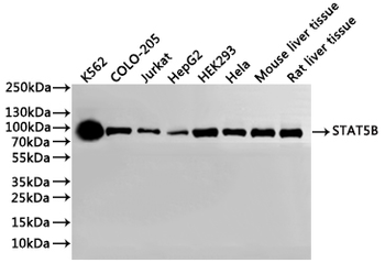 STAT5B Antibody