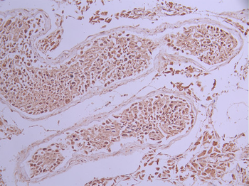 STAT5B Antibody