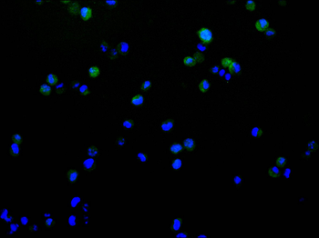 STAT5B Antibody