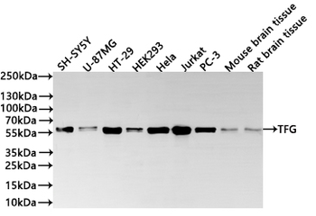 TFG Antibody