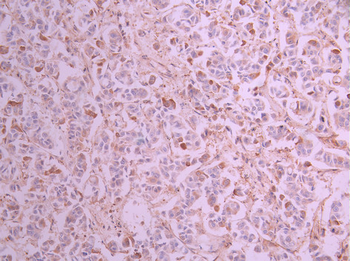 TFG Antibody