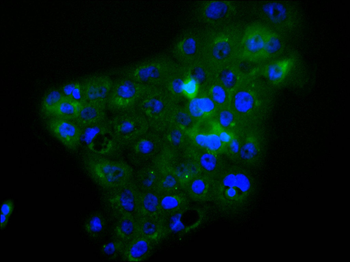 TFG Antibody