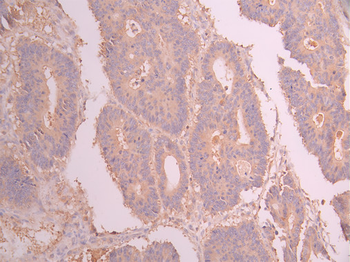 GUSB Antibody
