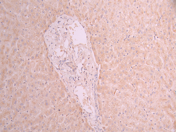 GUSB Antibody