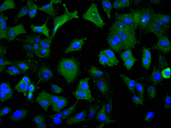 GUSB Antibody