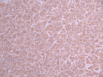 VEGFD Antibody