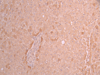 DPYD Antibody