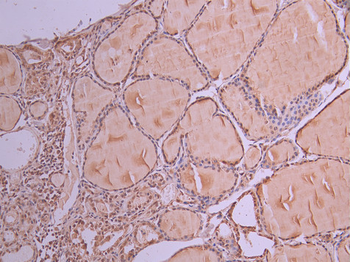 HTATSF1 Antibody