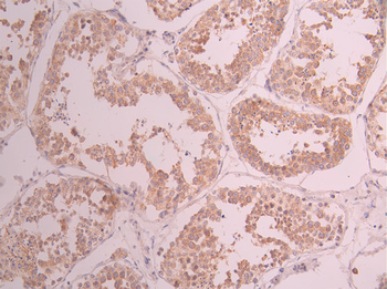 HSPA14 Antibody