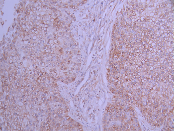 P4HB Antibody