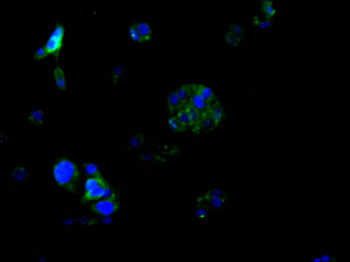 P4HB Antibody