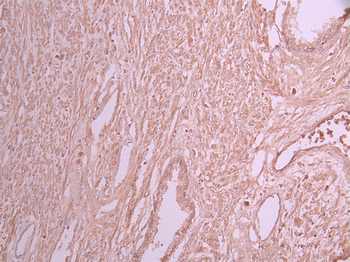 VPS28 Antibody