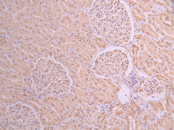 UBA1 Antibody