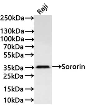 CDCA5 Antibody