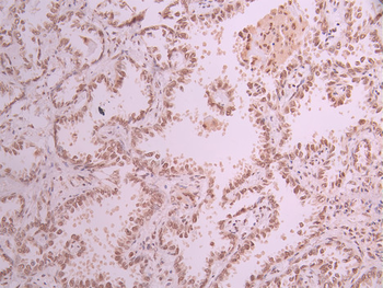 CDCA5 Antibody