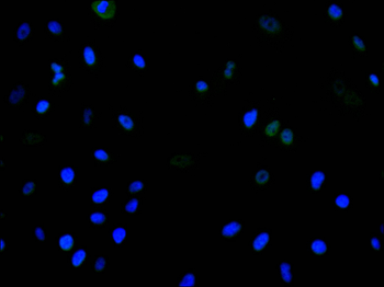 CDCA5 Antibody