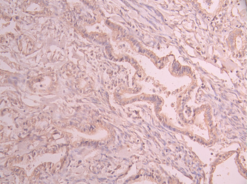 ARAF Antibody