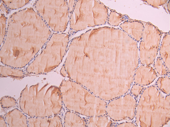 ARAF Antibody