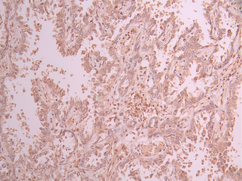 UBB Antibody
