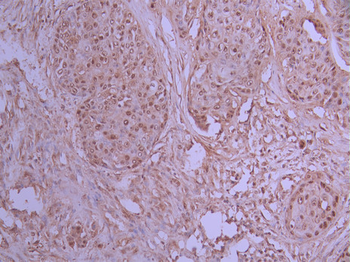UBB Antibody