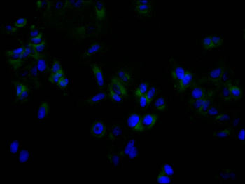 UBB Antibody
