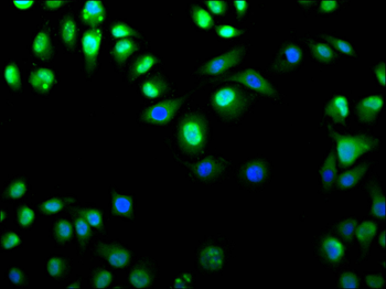 TSG101 Antibody