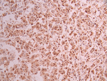 CIRBP Antibody