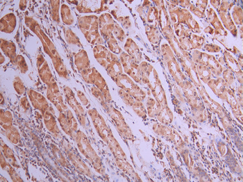 CIRBP Antibody