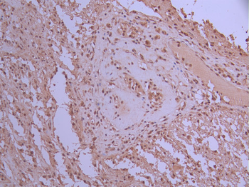 FUS Antibody
