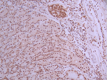 GTF2F2 Antibody