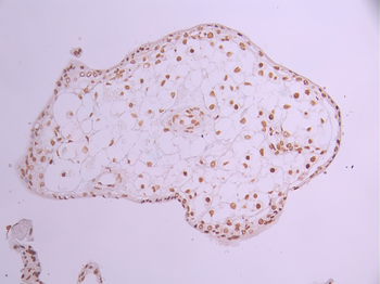 GTF2F2 Antibody