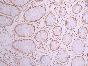 BRMS1 Antibody